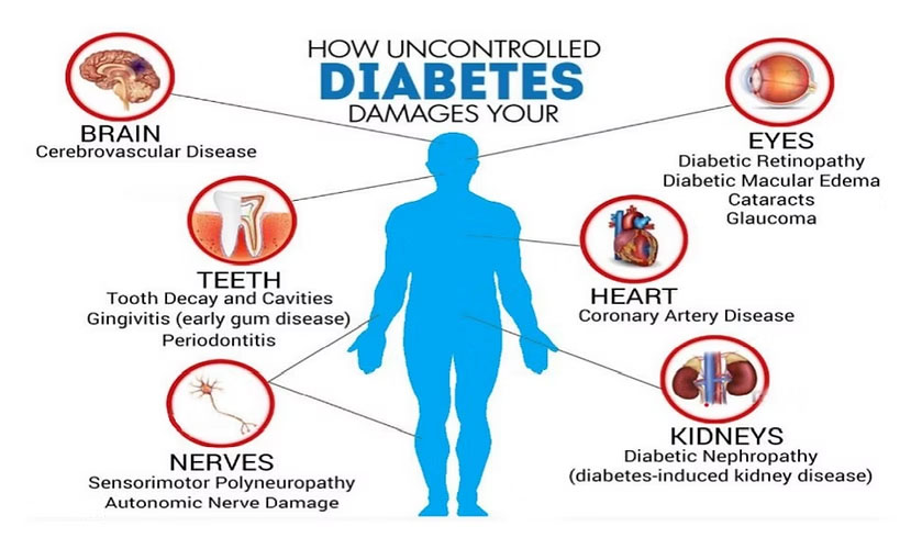 Illustration of a human silhouette showing how uncontrolled diabetes affects the brain, teeth, heart, eyes, kidneys, and nerves.